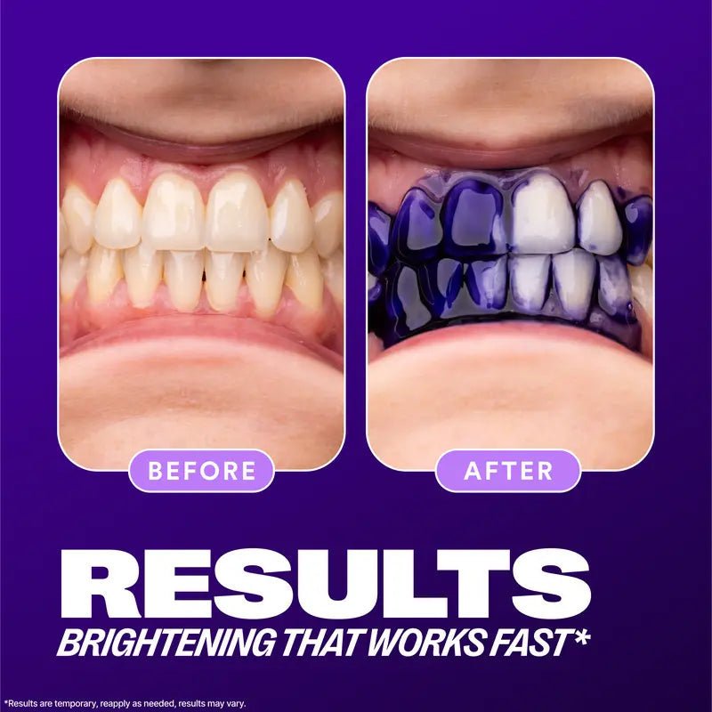 🏆 BEST SELLER - Tooth Stain Concealer