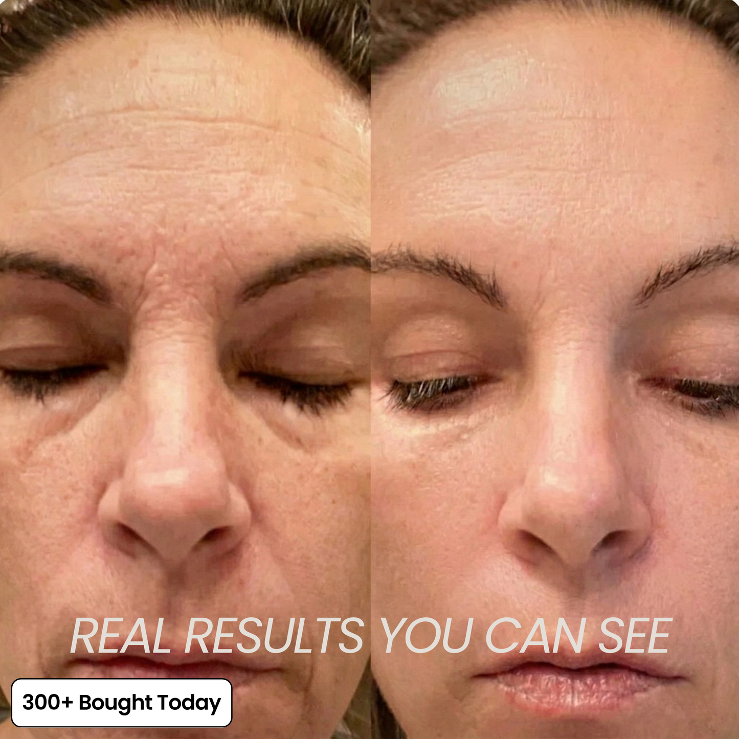 ⏰Last Day-Buy 1 Get 1 Free🔥 Calcium Multi Balm Eye Care Routine Korean Skin Care Anti-aging Cosmetics Collagen Eye Stick 9g