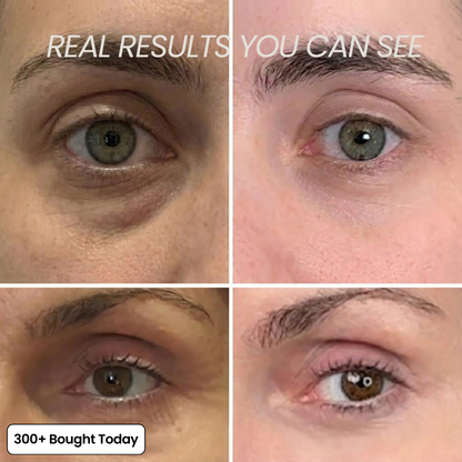 ⏰Last Day-Buy 1 Get 1 Free🔥 Calcium Multi Balm Eye Care Routine Korean Skin Care Anti-aging Cosmetics Collagen Eye Stick 9g